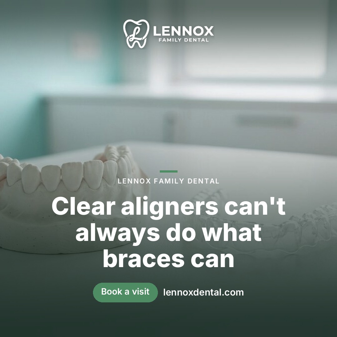 Invisalign vs Frenos Tradicionales: Cómo Elegir