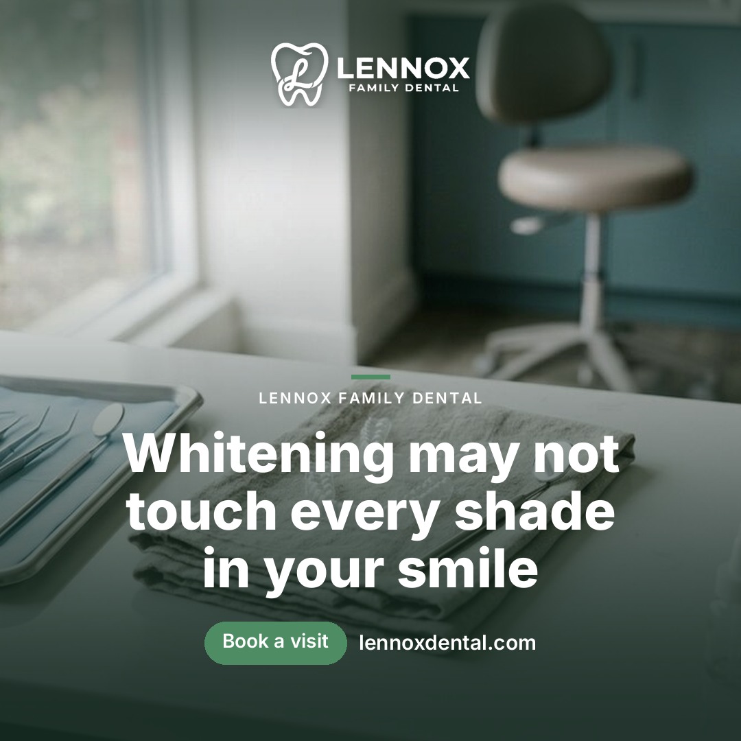 Professional Teeth Whitening: What to Know Before You Start